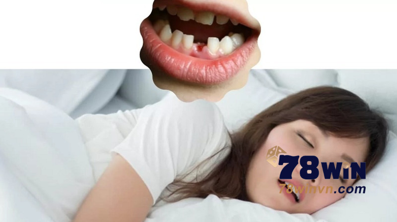 Nằm ngủ mơ thấy bị gãy răng